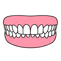 過蓋咬合（ディープバイト）