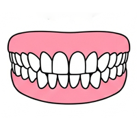 出っ歯（上顎前突）