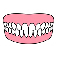 受け口（下顎前突）