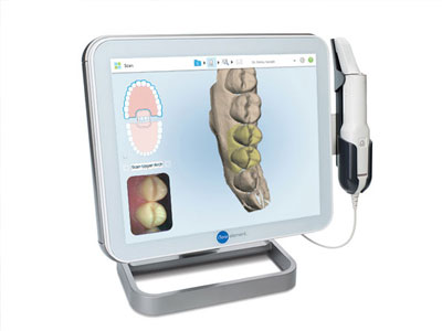 iTero スキャナー